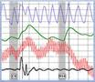 polygraph test